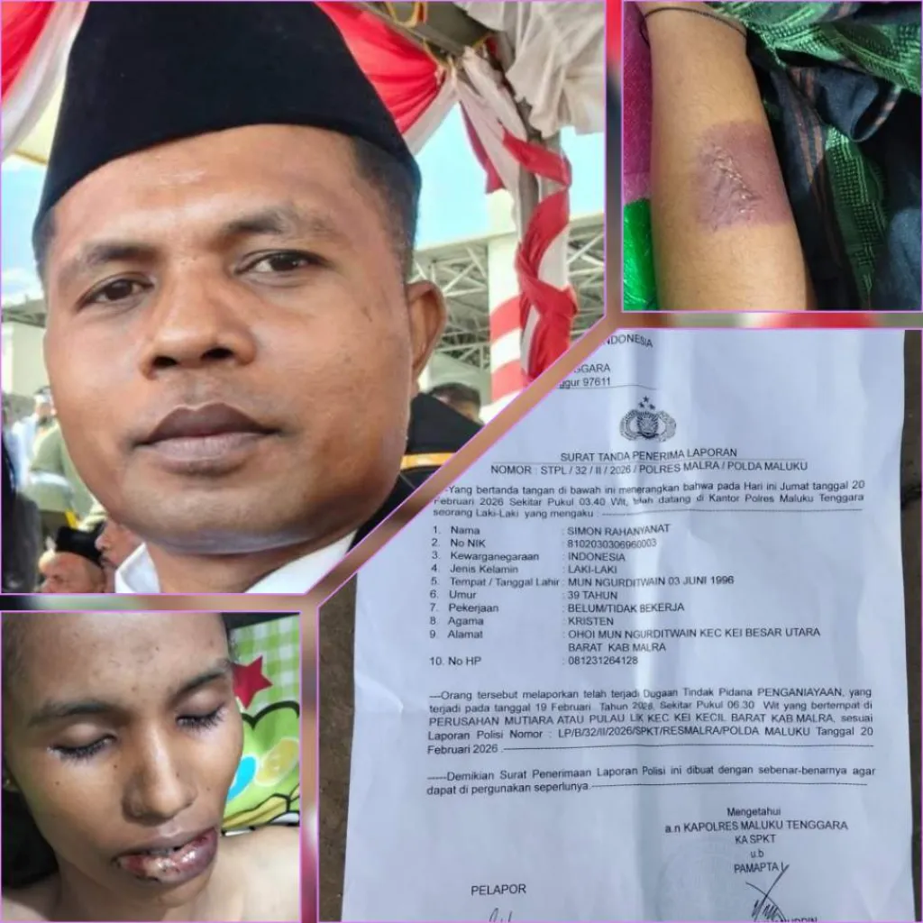 Memar di Tubuh Veronika: Siapa yang Bertanggung Jawab atas Kematian di Pulau Lik?