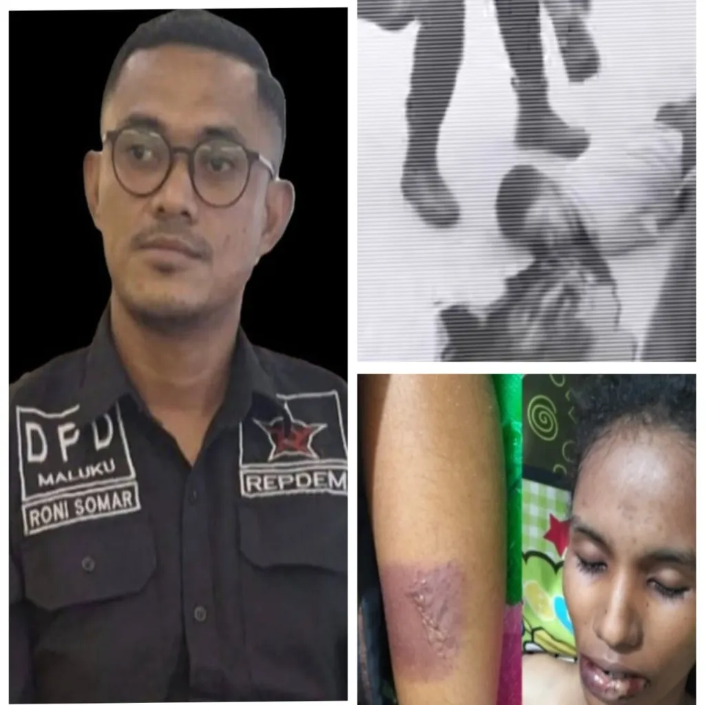 Sekretaris DPD Repdem Maluku Desak Pengusutan Tuntas Kasus Kematian Anak dan Ibu Veronica
